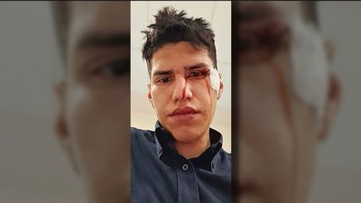 Hablamos con Deyvi, el camarero agredido por los ultras del Atlético que puede perder la vista de un ojo