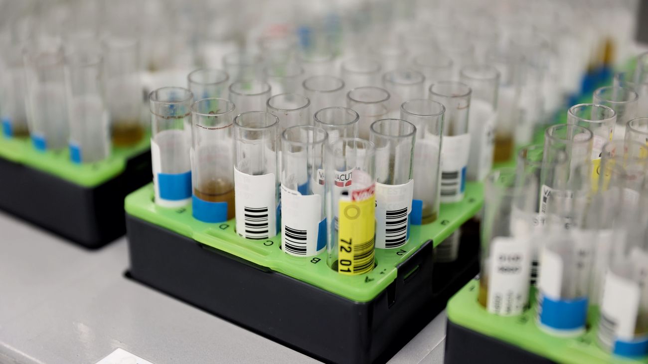 Probetas de PCR de Viruela del mono en el Laboratorio de Microbiología del Hospital público Gregorio Marañón