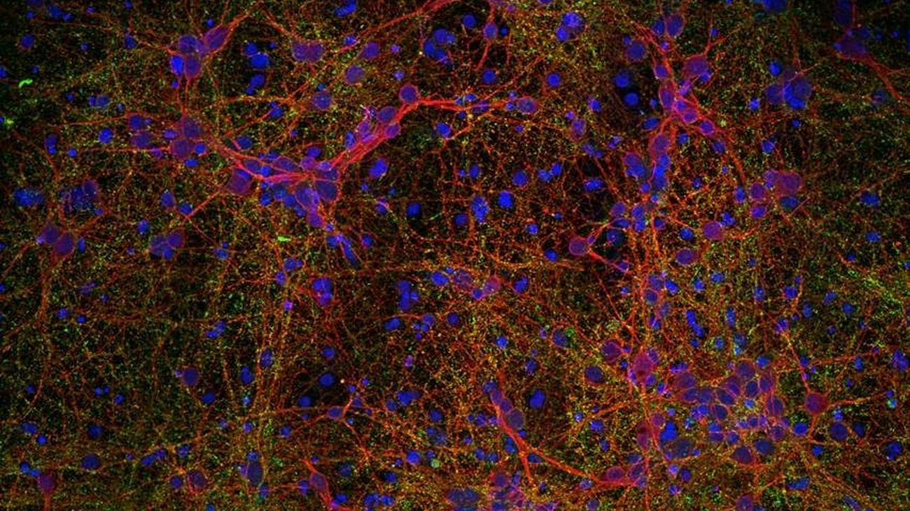 Imagen microscópica de células neurales con nanopartículas de óxido de hierro: neuronas (rojo), sinapsis (verde) y núcleos celulares (azul)