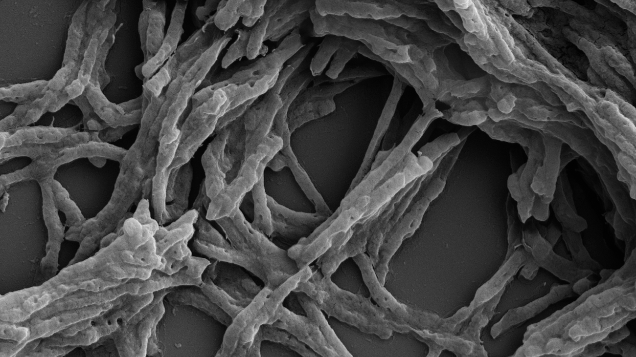 Mycobacterium smegmatis