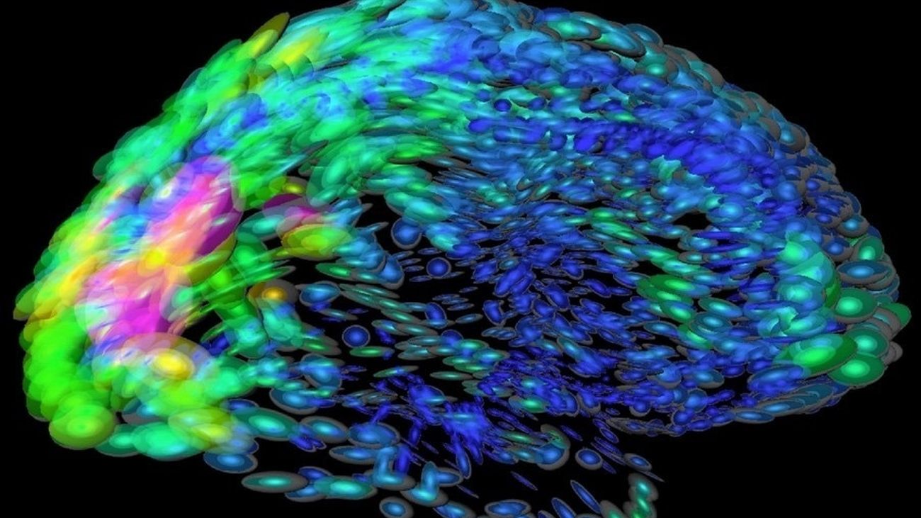 Imagen del cerebro que muestra en distintos colores las regiones con diferentes funciones.