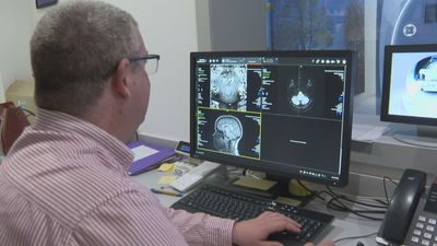 Una nueva máquina de resonancia magnética permite la detección precoz de enfermedades neurológicas