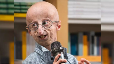 Muere Sammy Basso, el paciente con progeria más longevo del mundo